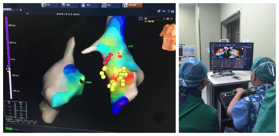 微电生理：公司三维标测系统已应用AI算法对室性心律失常的起源点进行判断